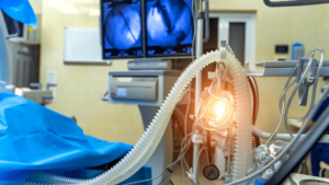 A ventilator in a medical room.